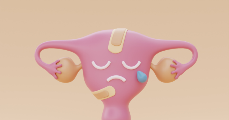 علاج تكيسات المبايض